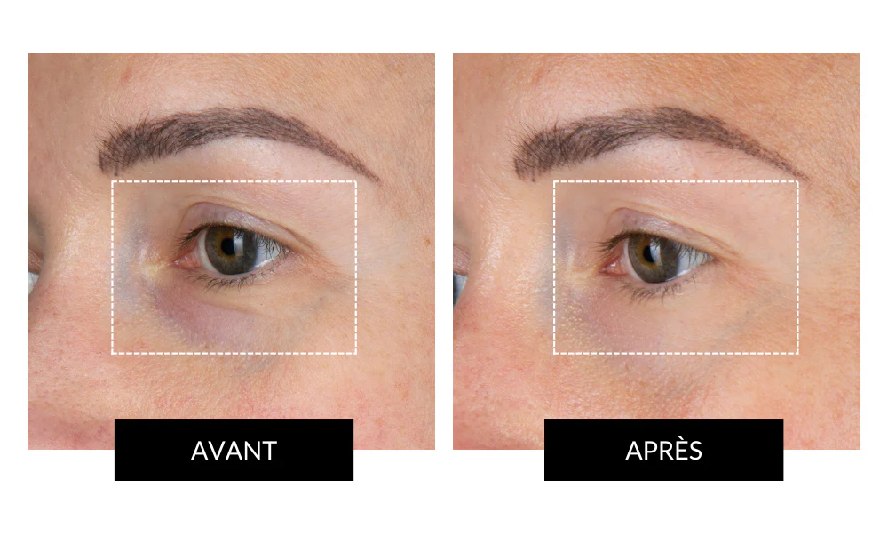 CurrentBody Skin LED Eye Perfector Offre - Image 4