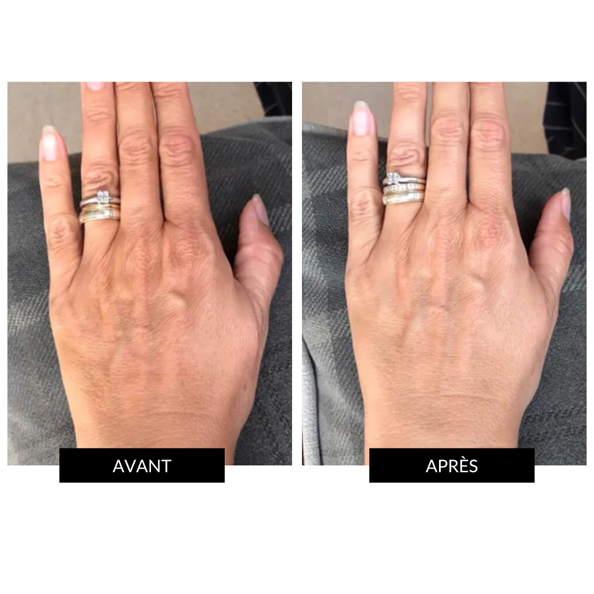 CurrentBody Skin LED Hand Perfector Offre - Image 4