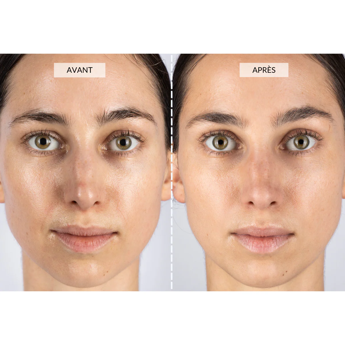 Masque LED visage - CurrentBody Skin Offre - Image 2